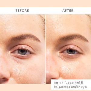 Soothing Eye Gels - The Collective Park City
